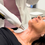 Donna sdraiata durante un trattamento estetico con dispositivo laser sul collo, eseguito da un’operatrice medica.